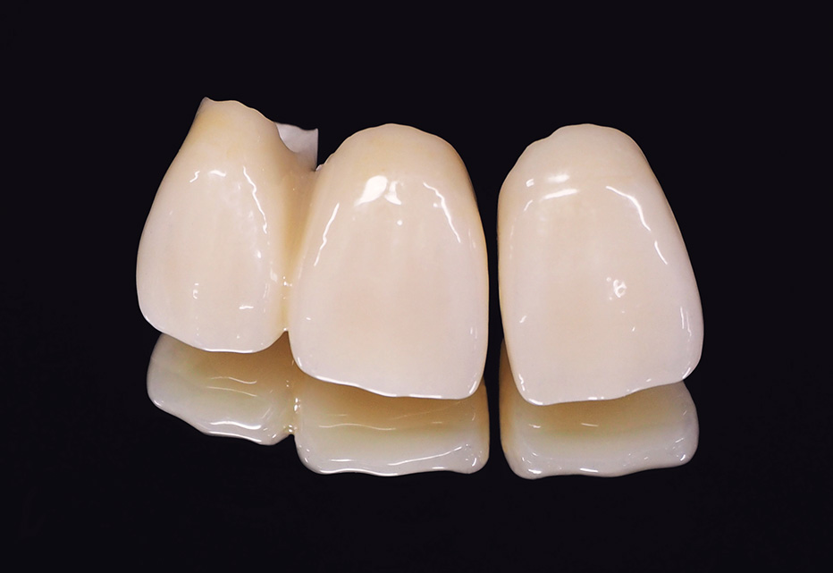 自由診療の種類02_ジルコニア