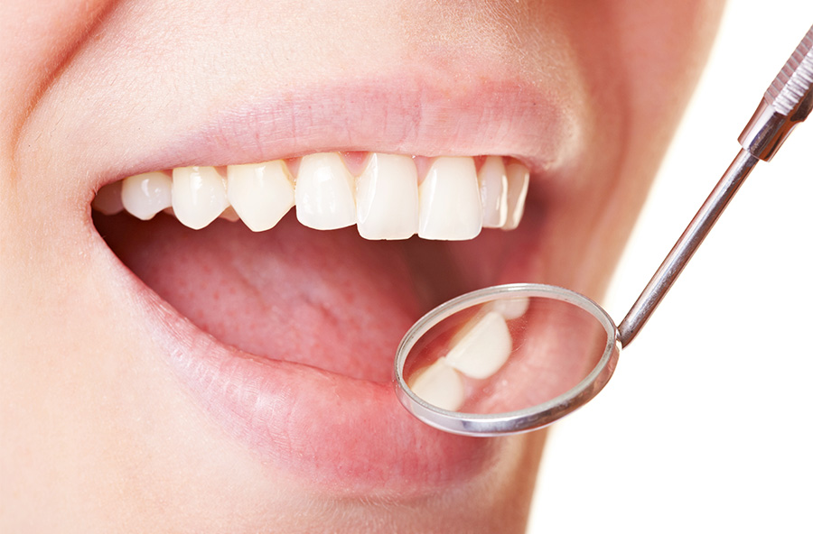 入れ歯製作の流れ02_初期治療