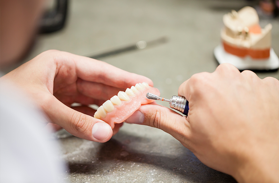 入れ歯製作の流れ05_歯科技工所での入れ歯製作